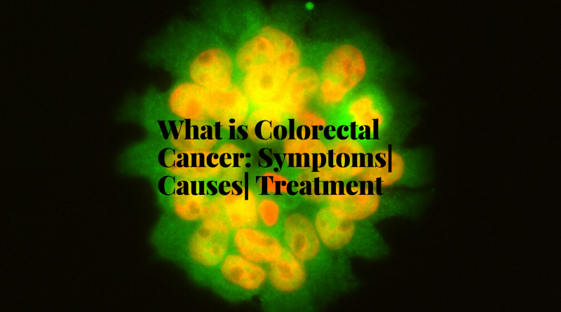 What-is-Colorectal-Cancer-Symptoms-Causes-Treatment