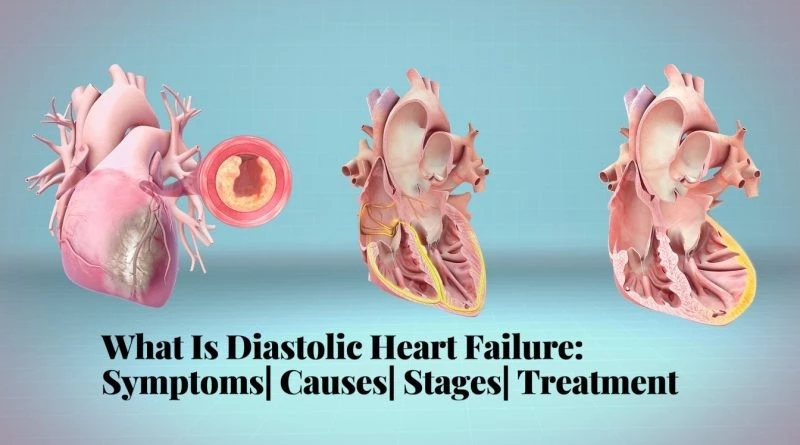 diastolic heart failure