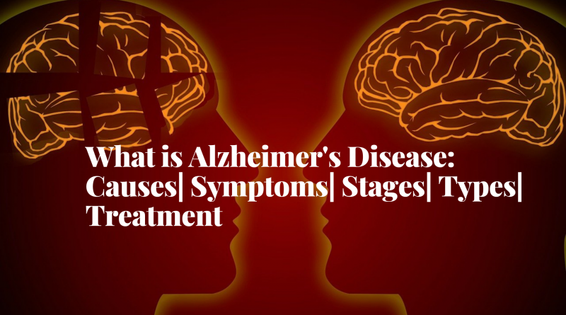 what-is-alzheimer's-disease-causes-symptoms-stages-types-treatment